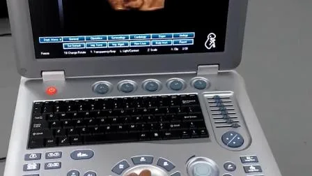 Medical Diagnostic Ob Gyn 3D Ultrasound Machine