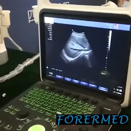 Portable Fetal Animal Veterinary Ultrasound Scanner for Abdomen and Pregnancy
