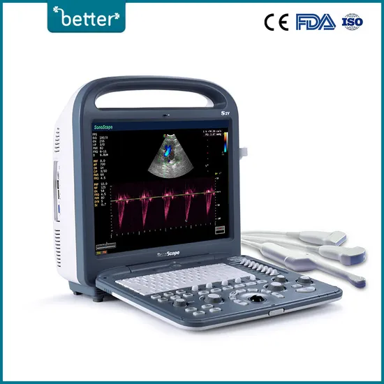 Ultrasound Machine Veterinary Diagnostic Sonoscape S2V 