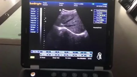 3D Vet Ultrasound B/W Laptop Dog Ultrasound Diagnostic for Animals