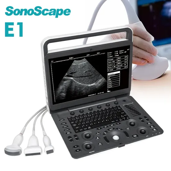 Sonoscape E2V Portable Vet Ultrasound Color Doppler Veterinary Diagnostic Ultrasound 