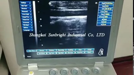 Mobile Ultrasound Manufacturer Trolley Ultrasound Price Software Diagnostic