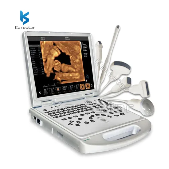 Karestar Veterinary Diagnostic Instrument Laptop 15 Inch LED Ultrasound Scan 4D 5D Color Doppler Ultrasound Machine 