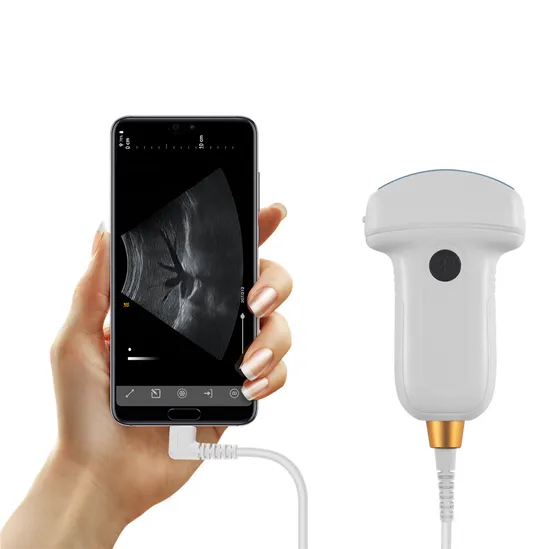 USB Probe Portable Color Doppler Pocket Veterinary Ultrasound Diagnostic Imaging System for Android 