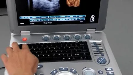 Pregnancy Diagnostic 3D Full Digital Ultrasound Echo Machine