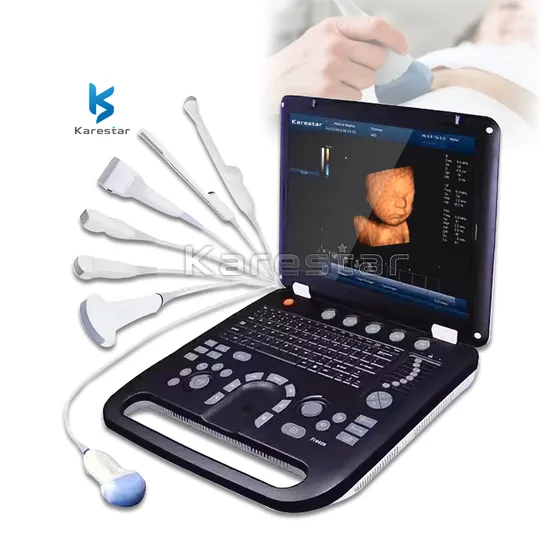 Portable Ultrasond Diagnostic Imaging System Veterinary Veterinary Ultrasound Machine 