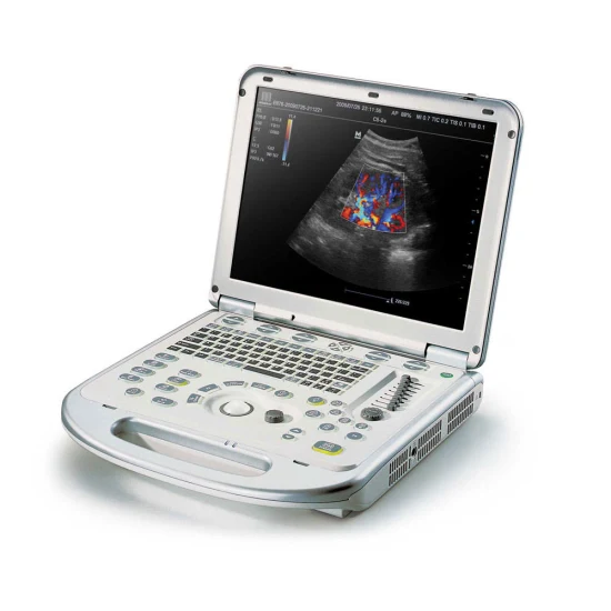Mindray M7 Premium Hand Carried Ultrasonic Diagnostic Imaging System Color Doppler Ultrasound System